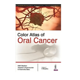 Jaypee Medical Color Atlas of Oral Cancer (ISBN - 524410)