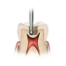 Ss White Surgical Length Carbide Fg Burs