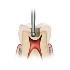 Ss White Surgical Length Carbide Fg Burs