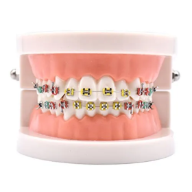 Patient Education Model With Orthodontic Brackets MD-119