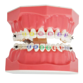Identical Orthodontic Patient Education Model (Ceramic) - M3002