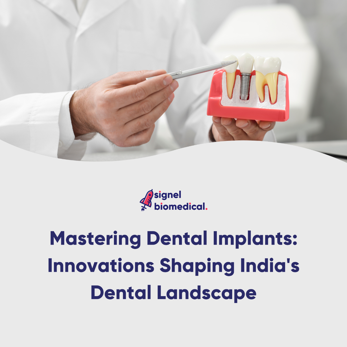 Which Handpiece Technology Should You Use for Dental Procedures in Your Dental Clinic?