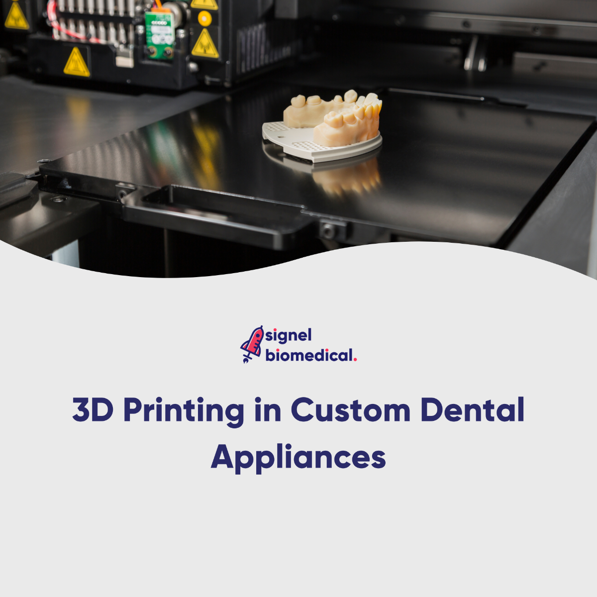 The Role of 3D Printing in Custom Dental Appliances for Indian Practices