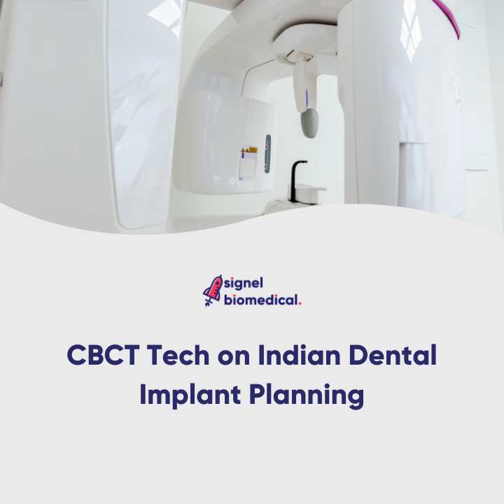The Impact of CBCT Technology on Indian Dental Implant Planning