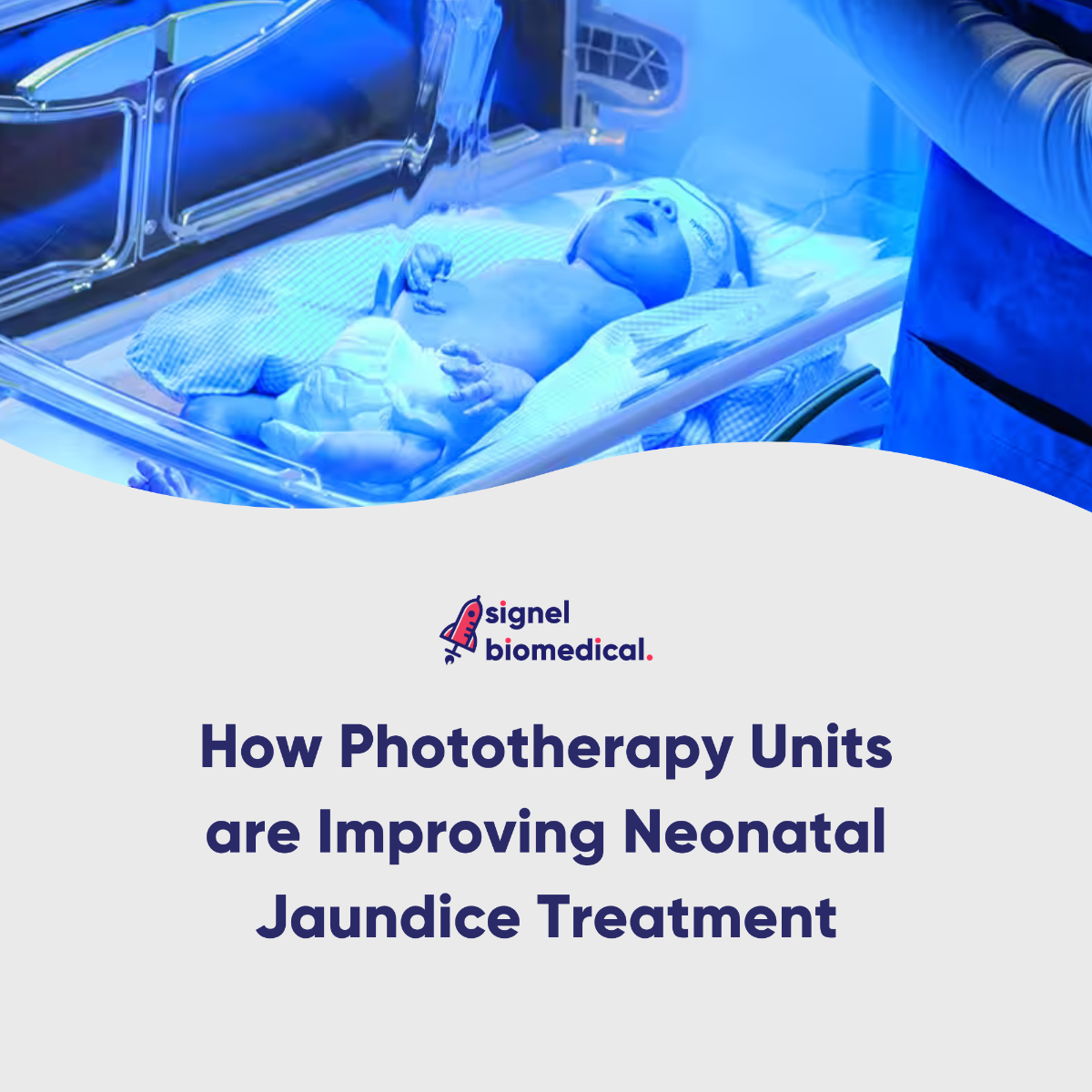 How Phototherapy Units are Improving Neonatal Jaundice Treatment
