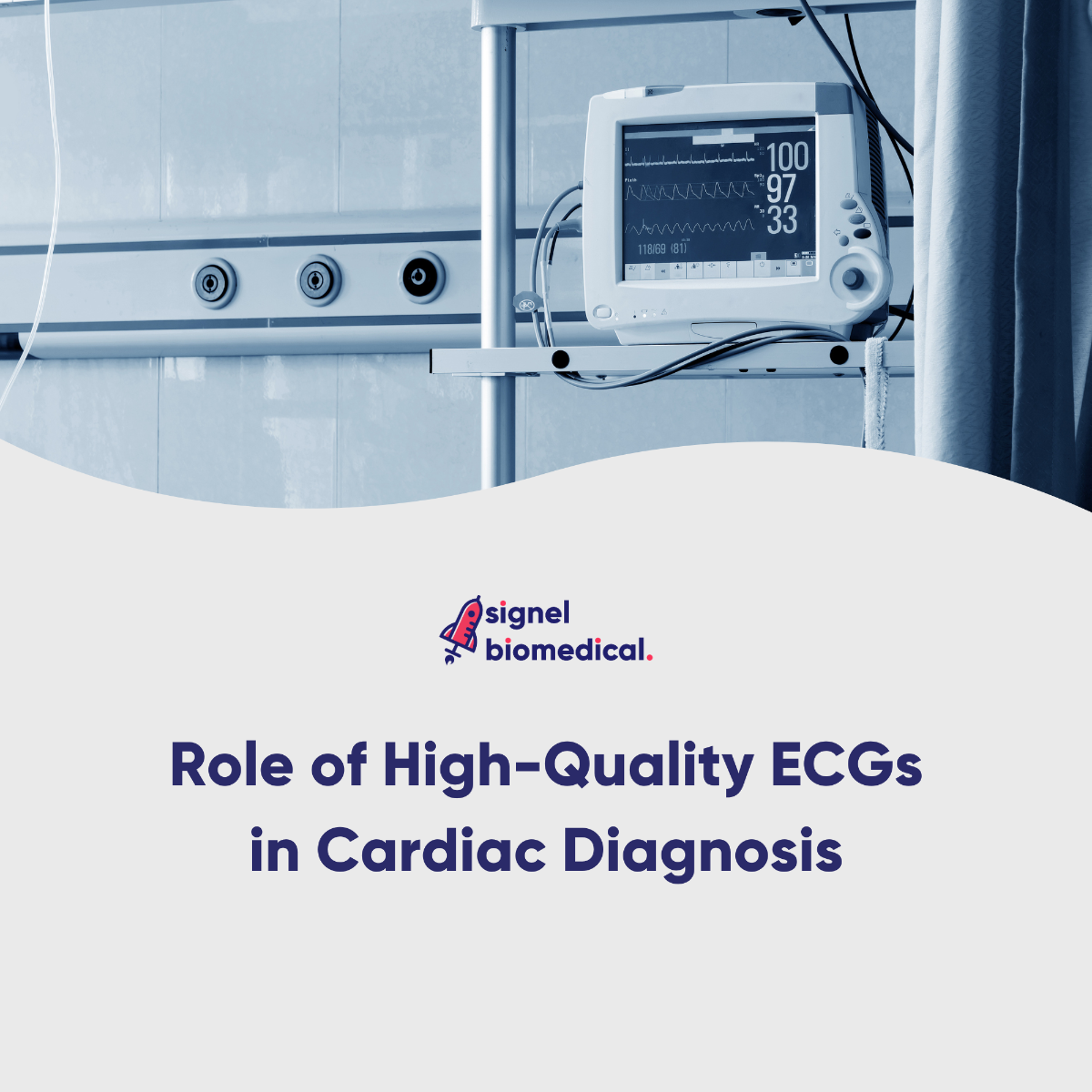 Role of High-Quality ECGs in Cardiac Diagnosis